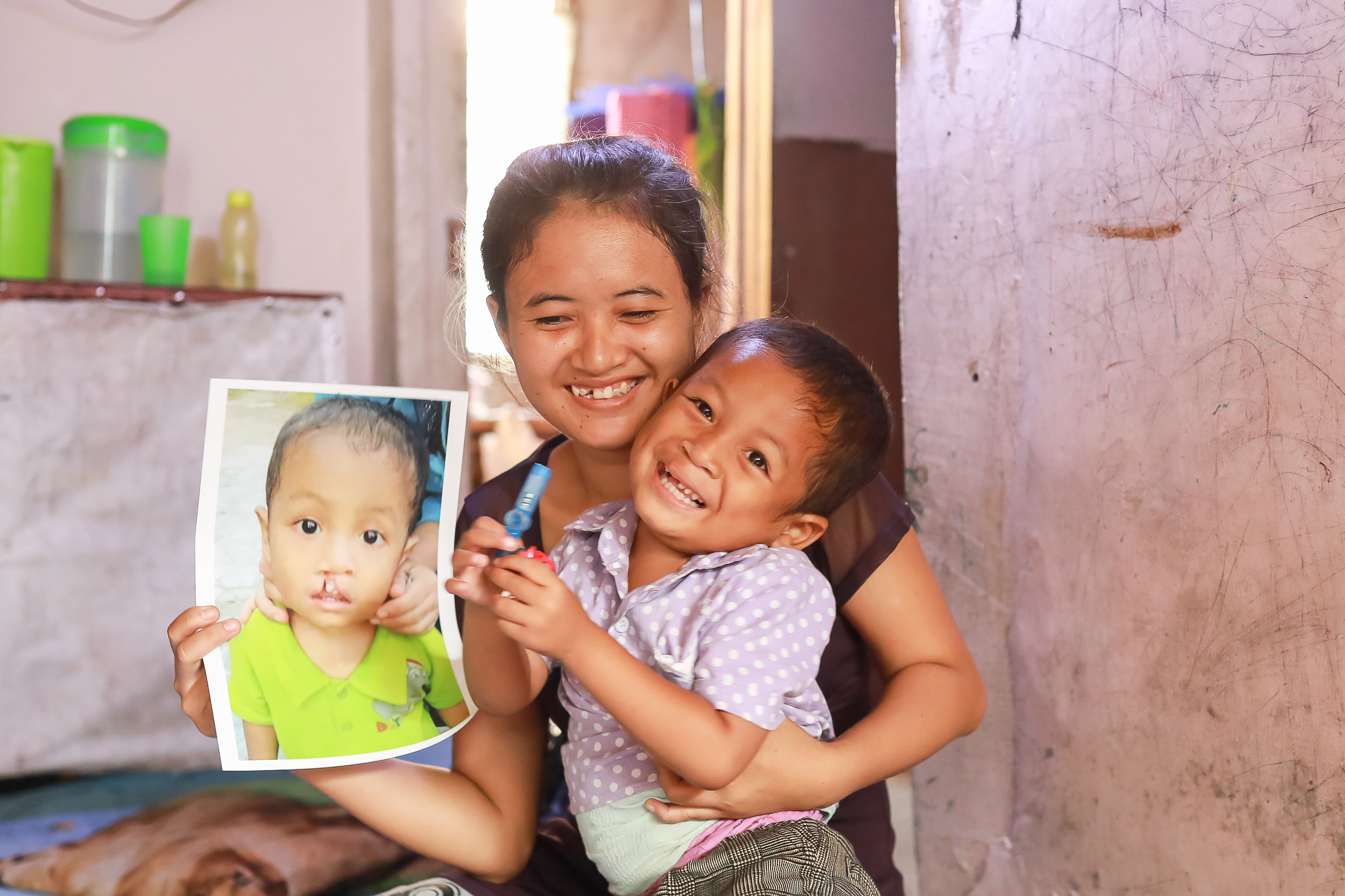 Darmawi smiling and holding her son Ikhsan and a picture of him before cleft surgery