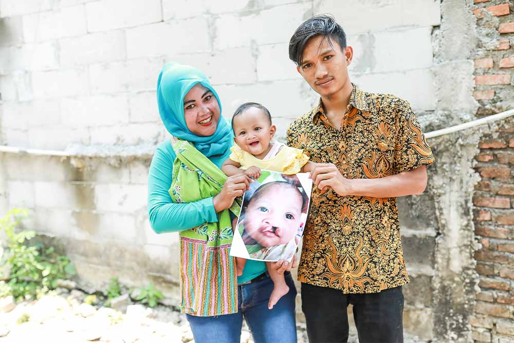 Umar and Sri smiling and holding Putri and a picture of her before cleft surgery