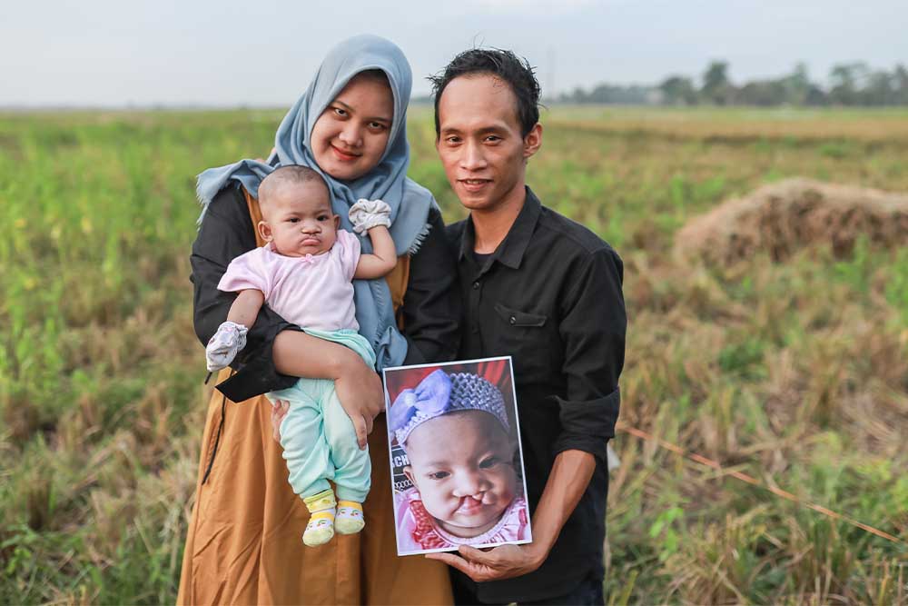 Haris and Nunung smiling and holding Rinda and a picture of her before cleft surgery