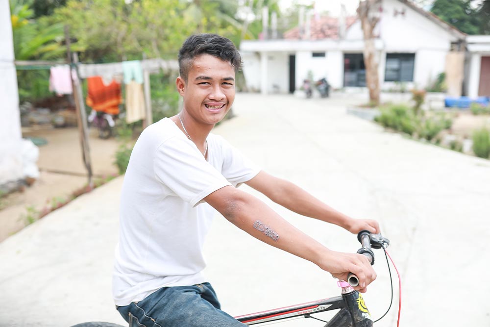 Angga smiling and riding his bike after cleft surgery