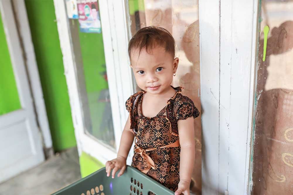 Siti usai operasi sumbing