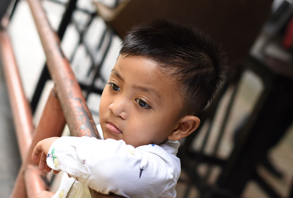 Biru looking into the distance after cleft surgery