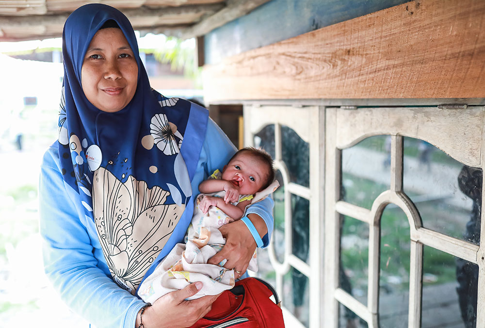Endang holding a cleft-affected baby before their cleft surgery