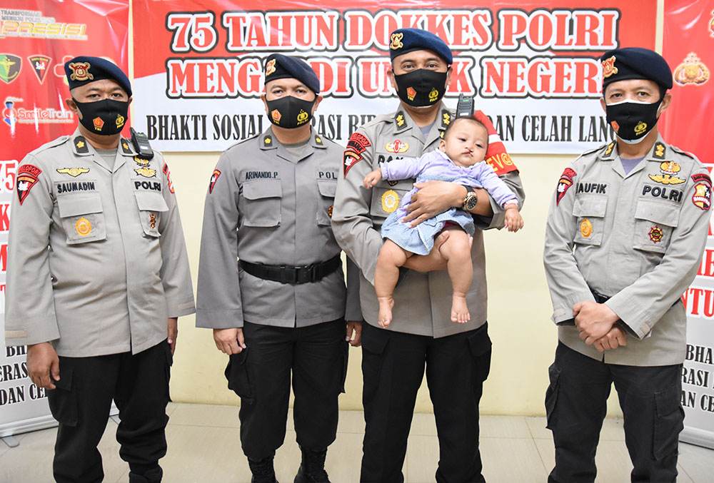 Indonesian police officers at ease, holding a cleft-affected baby