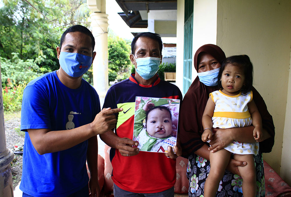 Rahmad smiling with a Smile Train patient and her family, holding a picture of her before cleft surgery
