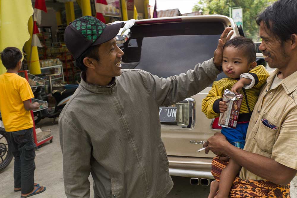Natsir greeting a cleft-affected child and their father