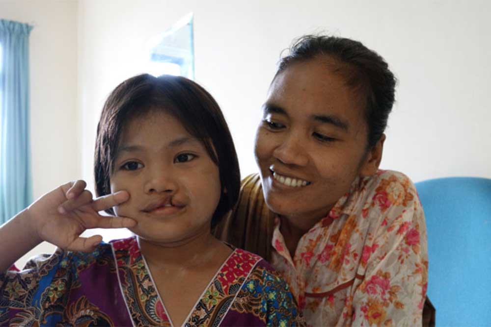 Smile Train patient Aulia smiling with her mother and flashing a peace sign before cleft surgery
