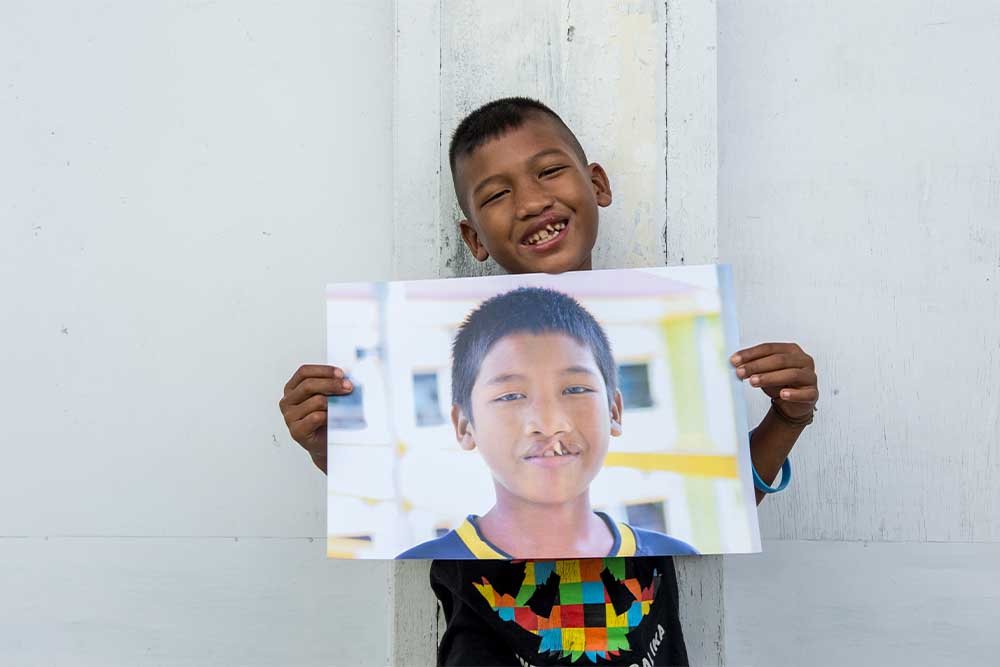 Aldan smiling and holding a photo of himself before cleft surgery