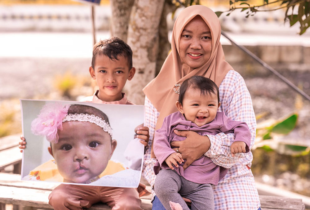 Divya tersenyum bersama Indri dan kakaknya sambil memegang foto dirinya sebelum operasi sumbing