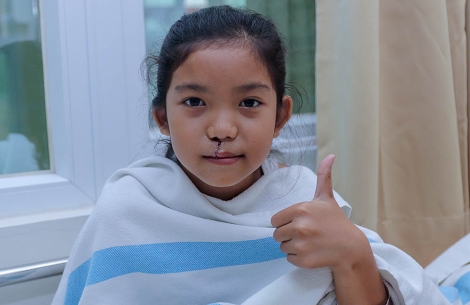 Smile Train patient give thumbs up after cleft surgery