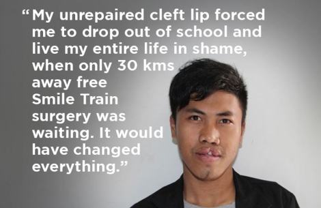 Sukma before cleft surgery - "My unrepaired cleft lip forced me to drop out of school and live my entire life in shame, when only 30 kms away free Smile Train surgery was waiting. It would have changed everything."