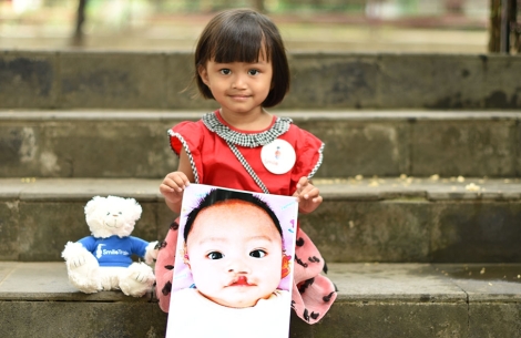 Khalisa smiling and holding a picture of herself before cleft surgery next to a teddy bear