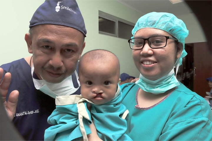 Dokter lokal Indonesia tersenyum dengan pasien yang terkena sumbing sebelum operasi sumbing