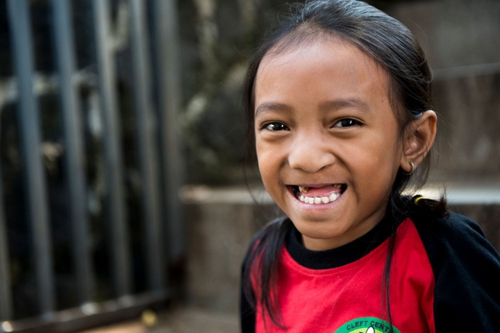 Smile Train patient smiling after cleft surgery