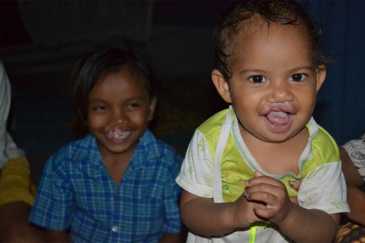 Two cleft-affected kids smiling