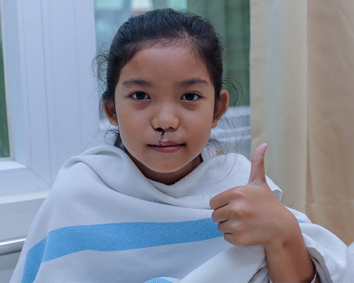 Smile Train patient give thumbs up after cleft surgery