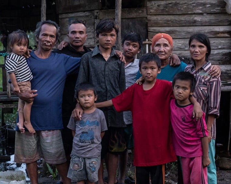 Alim dan Rajib tersenyum dengan keluarga mereka sebelum operasi bibir sumbing